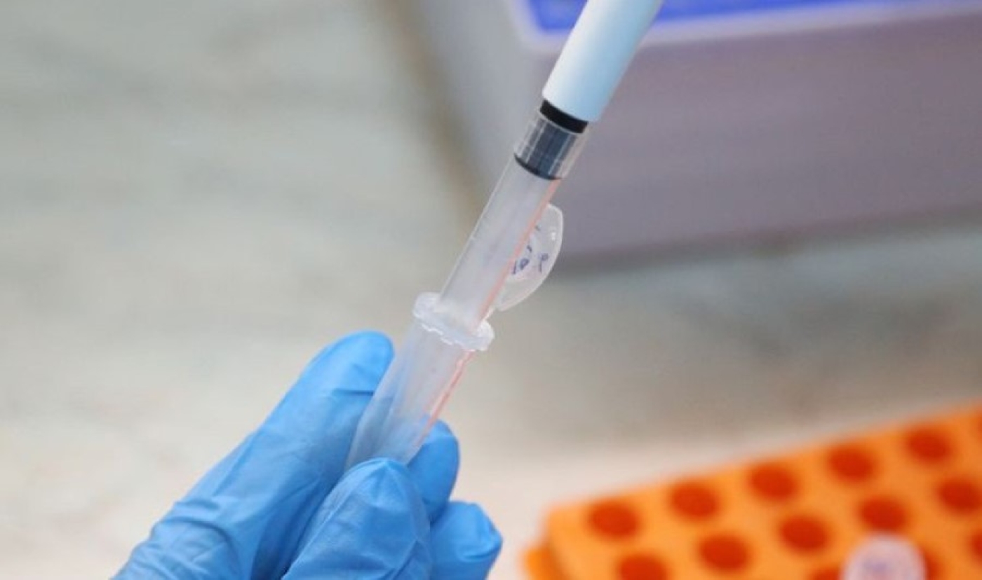 Бешеная куница напала на подростка в Жабинке, на нескольких улицах объявлен карантин