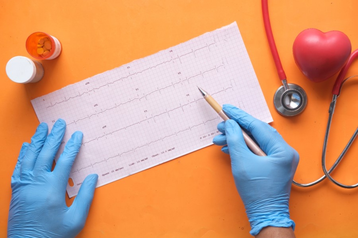 Синусовая аритмия: повод для тревоги или вариант нормы? Объясняет кардиолог