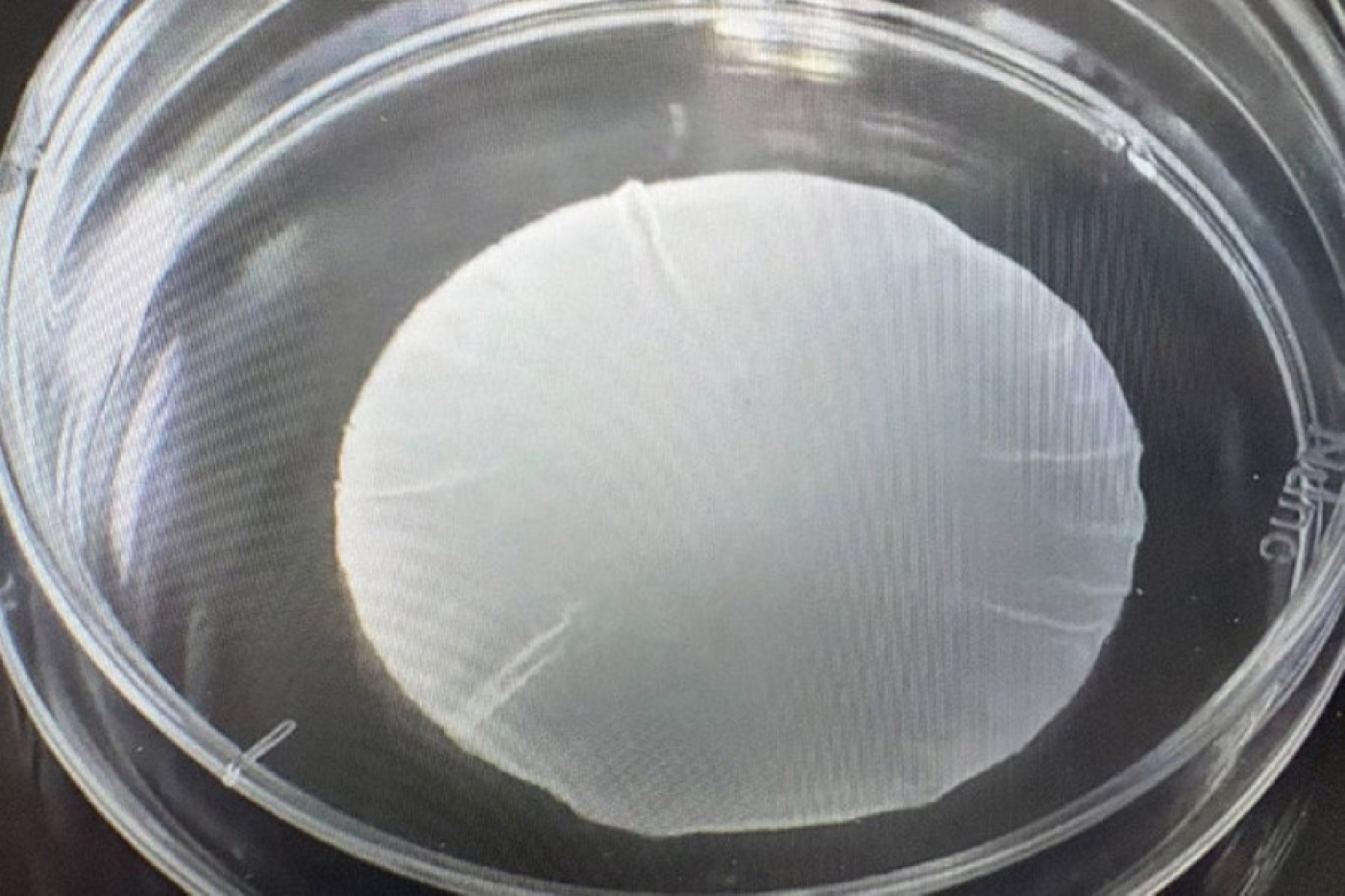 В Японии частично одобрили новый препарат для лечения болезни Паркинсона